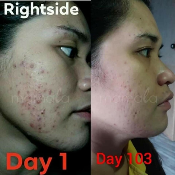 Mamala Soap - Picture 9 of 9